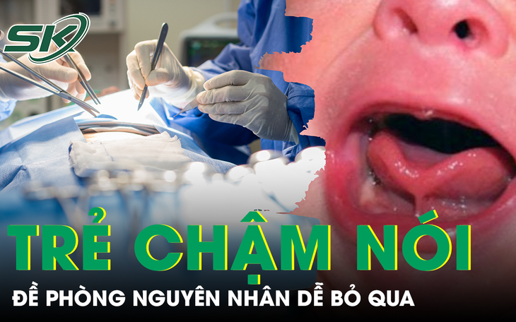 Đề phòng nguyên nhân gây chậm nói ở trẻ nhiều phụ huynh dễ bỏ qua