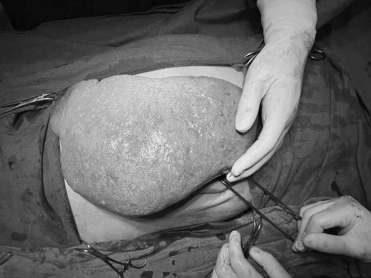 Cường lách: Nguyên nhân, triệu chứng, cách điều trị và phòng ngừa - Ảnh 1. Cường lách: Nguyên nhân, triệu chứng, cách điều trị và phòng ngừa - Ảnh 1.