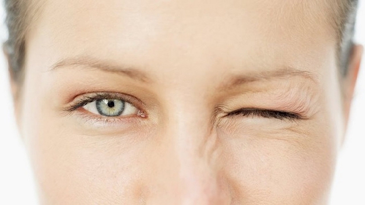 Co giật mí mắt (Eye Twitching) là tình trạng mí mắt co thắt lặp đi lặp lại không kiểm soát.