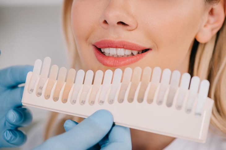 9 cách để làm trắng răng bị ố vàng- Ảnh 1.