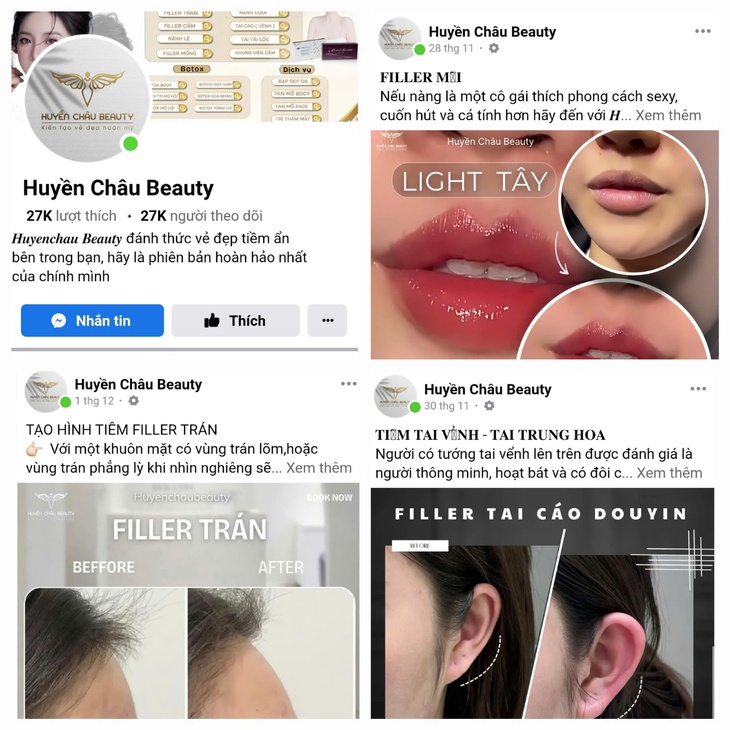 Viết bản cam kết 'không thực hiện' nhưng Huyền Châu Beauty vẫn mời khách hàng đến tiêm môi- Ảnh 2.