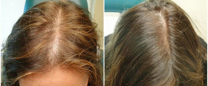 Cách để giúp tóc mọc nhanh vào mùa đông- Ảnh 2.