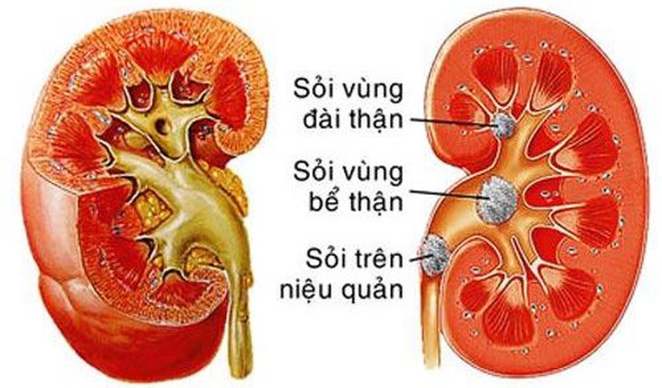 Nguy cơ tiềm ẩn khi không uống đủ nước trong mùa đông- Ảnh 2.