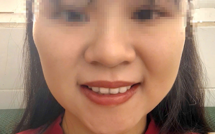 Hai người phụ nữ liệt toàn thân sau khi đi tiêm botox để làm đẹp- Ảnh 3.