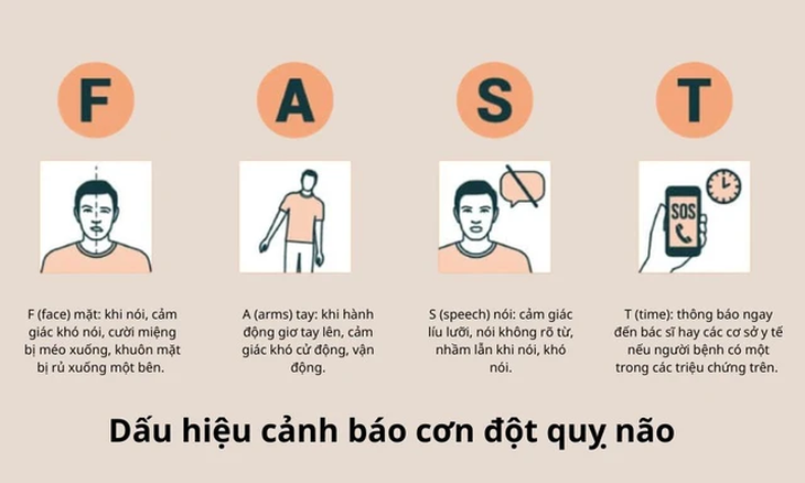 Bác sĩ cảnh báo phương pháp chữa đột quỵ bằng 'ho mạnh, sấy vào gáy'- Ảnh 2.