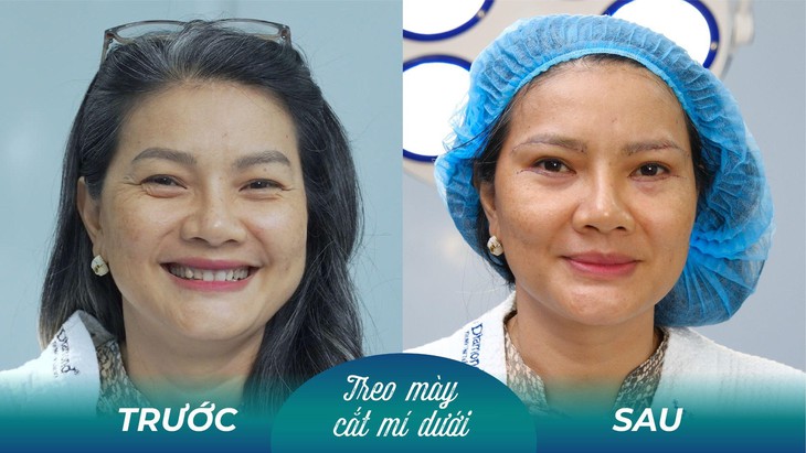 Diễn viên Kiều Trinh can thiệp thẩm mỹ trị sụp mí ở tuổi 50- Ảnh 2. Diễn viên Kiều Trinh can thiệp thẩm mỹ trị sụp mí ở tuổi 50- Ảnh 2.