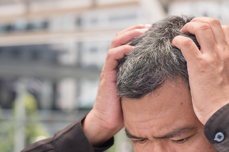 7 giải pháp giúp bạn đối phó với nỗi lo tóc bạc sớm- Ảnh 1.