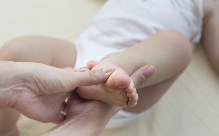 Bài tập hỗ trợ điều trị cho trẻ bị khoèo chân bẩm sinh