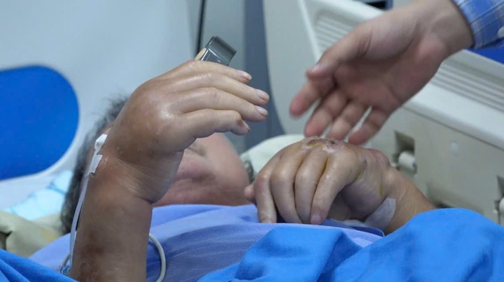 Người đàn ông bị nhiễm trùng huyết nghiêm trọng do tự ý điều trị gout bằng thuốc tại nhà- Ảnh 1. Người đàn ông bị nhiễm trùng huyết nghiêm trọng do tự ý điều trị gout bằng thuốc tại nhà- Ảnh 1.