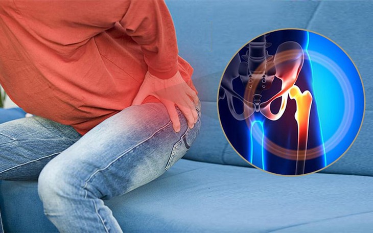 Các phương pháp điều trị hoại tử chỏm xương đùi- Ảnh 1. Các phương pháp điều trị hoại tử chỏm xương đùi- Ảnh 1.