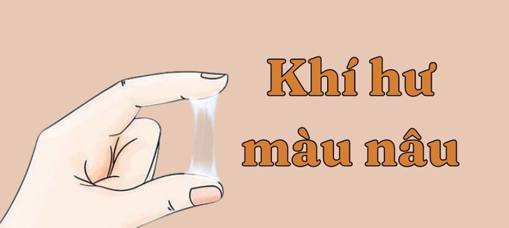 Bên cạnh khí hư sinh lý, trong nhiều trường hợp khí hư là biểu hiện của các bệnh lý đường sinh dục.