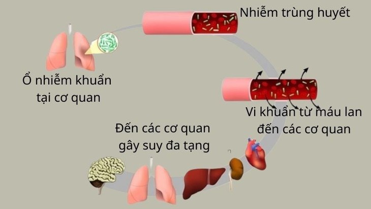 Những thuốc nào dùng trong điều trị hội chứng sốc nhiễm độc?- Ảnh 1.