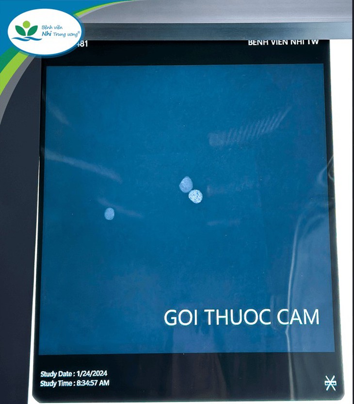 Chữa bệnh bằng thuốc cam, bé gái 9 tuổi nguy kịch vì ngộ độc chì nặng- Ảnh 2.
