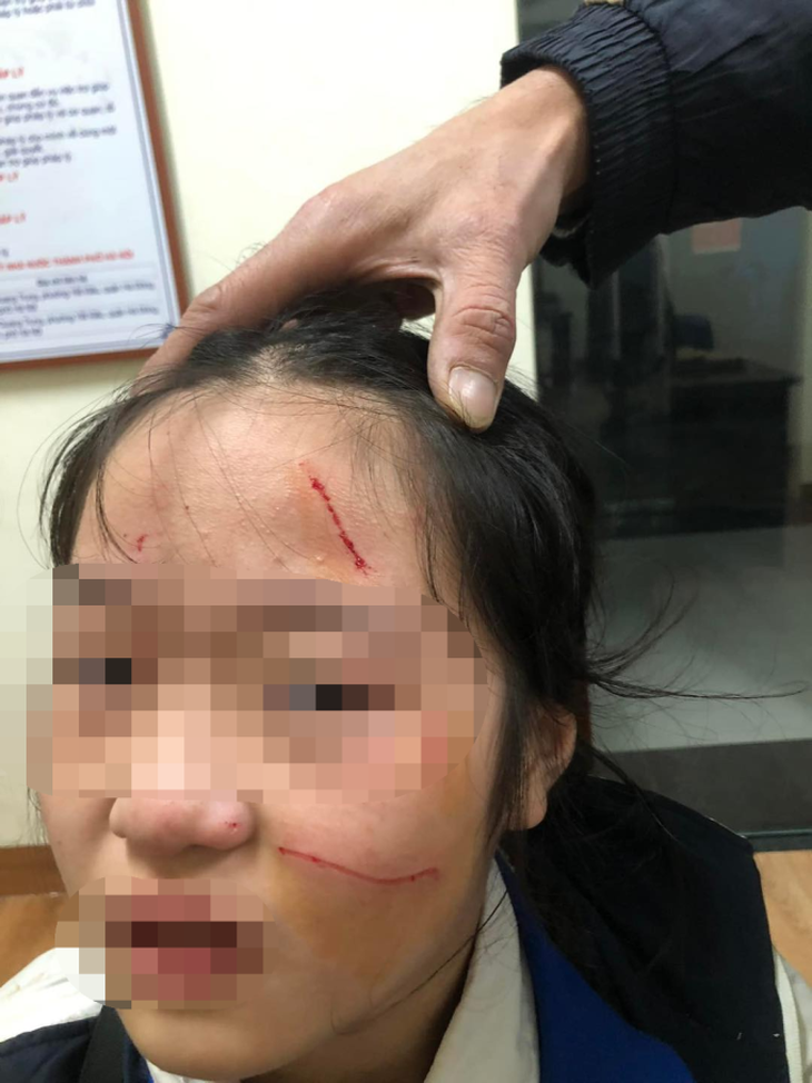 Vụ nữ sinh lớp 6 ở Hà Nội bị bạn đánh chảy máu mặt: UBND quận yêu cầu xác minh- Ảnh 1. Vụ nữ sinh lớp 6 ở Hà Nội bị bạn đánh chảy máu mặt: UBND quận yêu cầu xác minh- Ảnh 1.