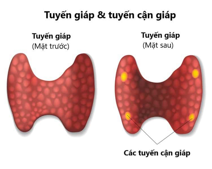 Người bệnh suy tuyến cận giáp cần làm gì để nâng cao chất lượng cuộc sống?- Ảnh 1. Người bệnh suy tuyến cận giáp cần làm gì để nâng cao chất lượng cuộc sống?- Ảnh 1.
