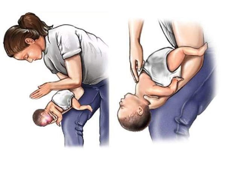 Tai nạn thương tích hay gặp ở trẻ dịp Tết và cách sơ cứu, phòng tránh- Ảnh 1. Tai nạn thương tích hay gặp ở trẻ dịp Tết và cách sơ cứu, phòng tránh- Ảnh 1.
