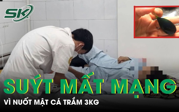 Người phụ nữ suýt mất mạng vì nuốt mật cá trắm 3kg