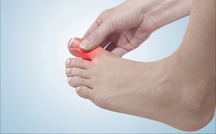 Cách phân biệt đau do mắc gout và viêm khớp dạng thấp
