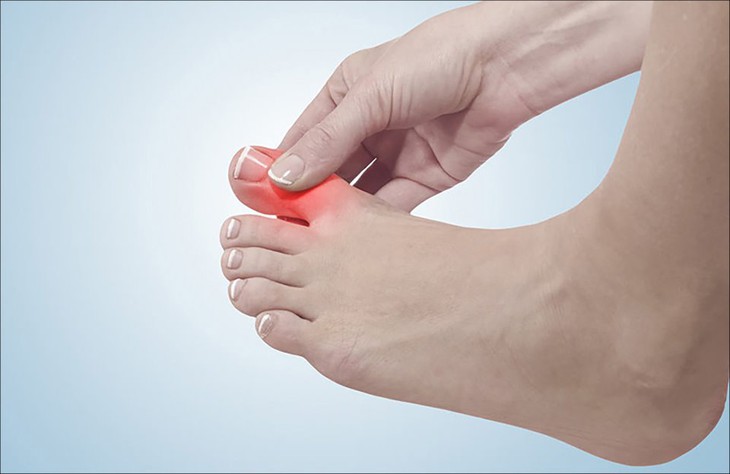 Để điều trị được, điều quan trọng là phải xác định các triệu chứng của bệnh Gout và viêm khớp dạng thấp. Để điều trị được, điều quan trọng là phải xác định các triệu chứng của bệnh Gout và viêm khớp dạng thấp.