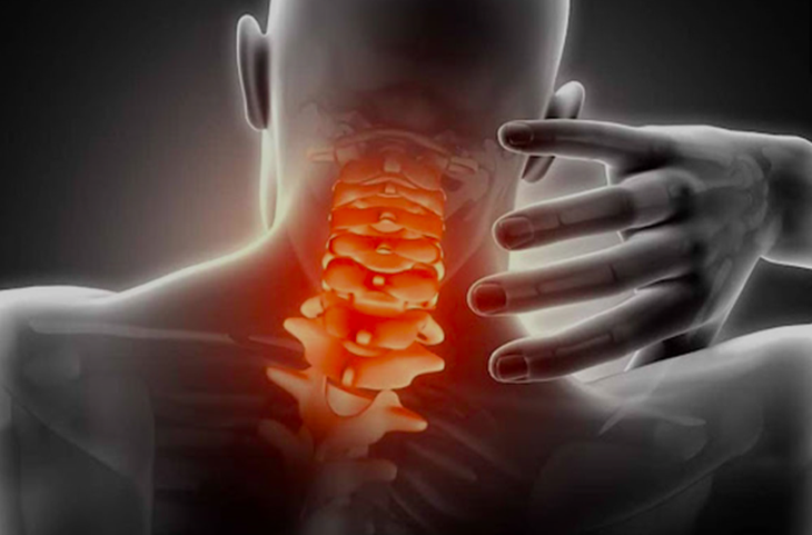 Đau cổ vai gáy có thể bị liệt nếu điều trị sai cách- Ảnh 1.