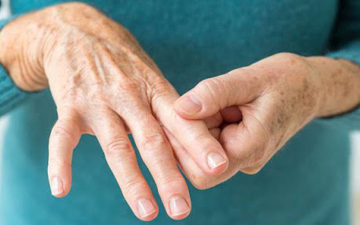 Những triệu chứng nguy hiểm của viêm khớp dạng thấp