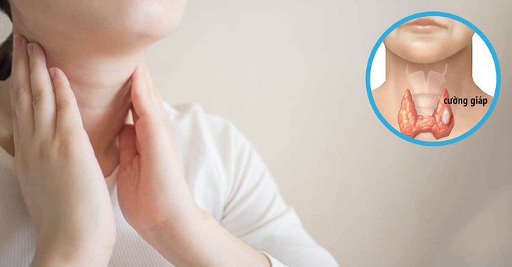 Bệnh lý tuyến giáp có nguy hiểm không?- Ảnh 1. Bệnh lý tuyến giáp có nguy hiểm không?- Ảnh 1.