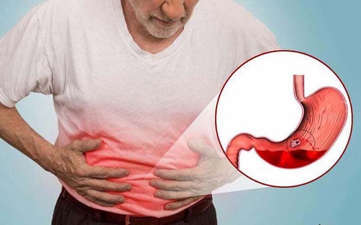 Đau dạ dày: Nguyên nhân, triệu chứng, lây truyền và cách điều trị
