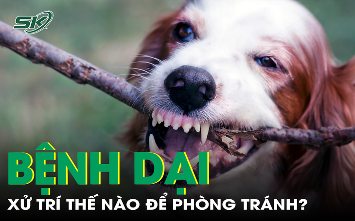Cách xử trí vết thương để tránh bệnh dại khi bị chó mèo cắn