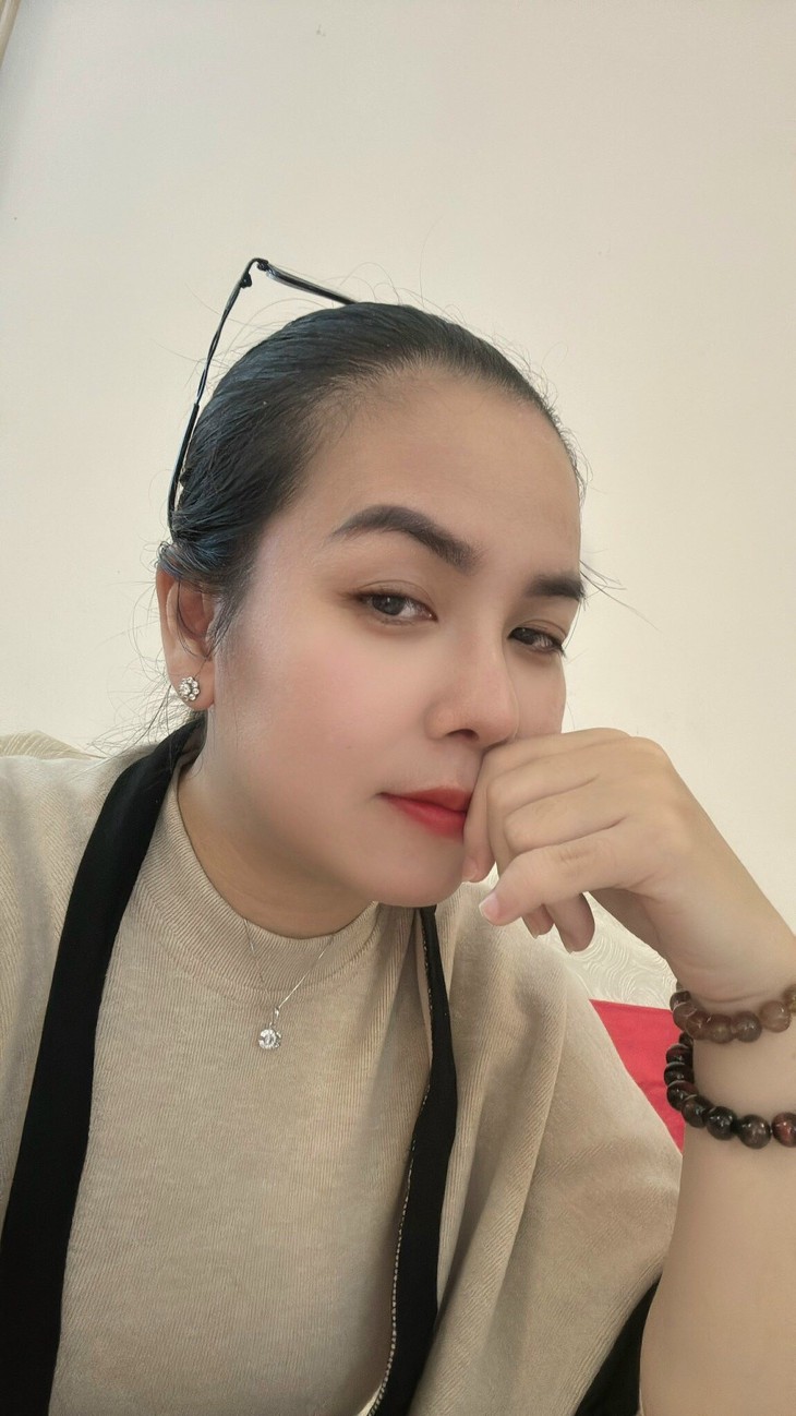 Nâng mũi có đau không từ câu chuyện làm đẹp của cô kế toán- Ảnh 3. Nâng mũi có đau không từ câu chuyện làm đẹp của cô kế toán- Ảnh 3.