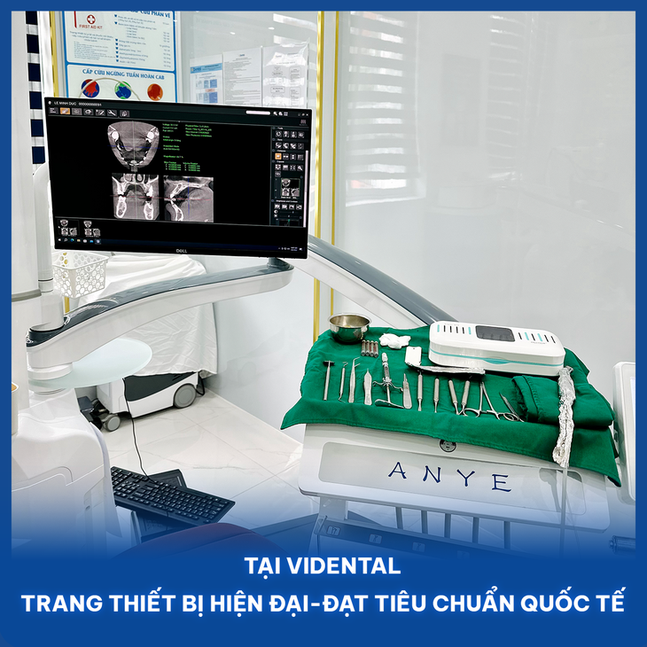 Niềng răng mắc cài kim loại có đau không? Nên niềng răng ở đâu?- Ảnh 3.
