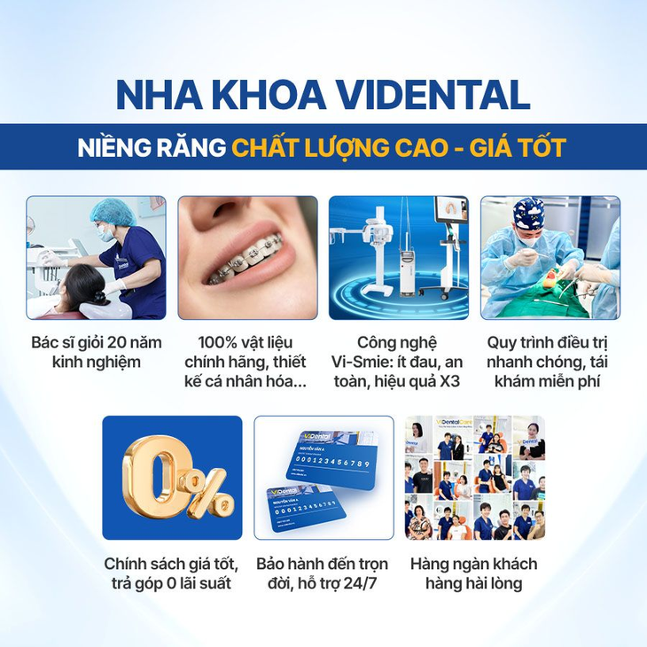 Niềng răng giá bao nhiêu? Gợi ý địa chỉ uy tín- Ảnh 4.