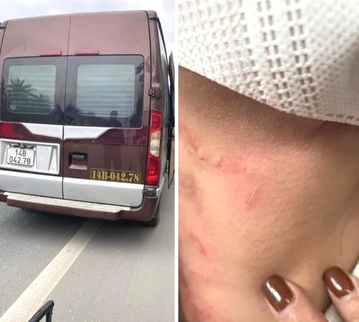 Thông tin mới nhất vụ nữ hành khách tố nhà xe bóp cổ, bỏ mặc giữa cao tốc- Ảnh 1.