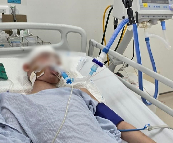 Thông tin mới vụ học sinh lớp 8 bị đánh chấn thương sọ não khi chơi bóng rổ- Ảnh 1.