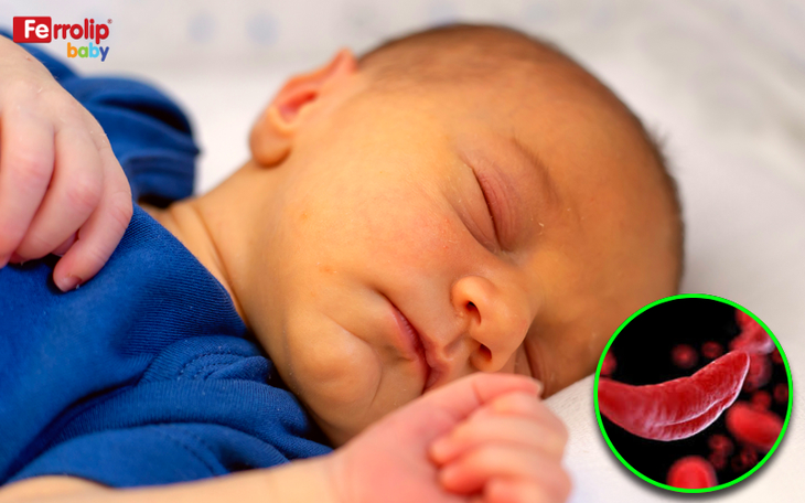 Tìm hiểu các nguyên nhân khiến trẻ thiếu máu suy dinh dưỡng và cách phòng ngừa- Ảnh 1. Tìm hiểu các nguyên nhân khiến trẻ thiếu máu suy dinh dưỡng và cách phòng ngừa- Ảnh 1.