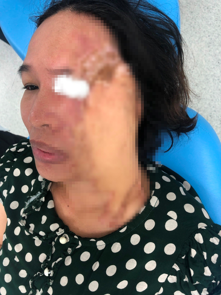Người phụ nữ suốt 23 năm gặp khó khăn khi mở miệng nói chuyện và ăn uống- Ảnh 1.