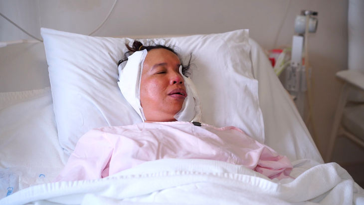 Người phụ nữ suốt 23 năm gặp khó khăn khi mở miệng nói chuyện và ăn uống- Ảnh 2.