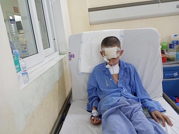 Xót thương hoàn cảnh nam sinh lớp 8 bị biến dạng khuôn mặt vì bệnh- Ảnh 1. Xót thương hoàn cảnh nam sinh lớp 8 bị biến dạng khuôn mặt vì bệnh- Ảnh 1.