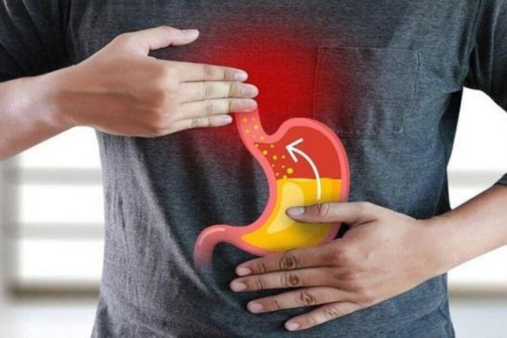 Viêm loét dạ dày – thậm chí khi không lạm dụng rượu bia- Ảnh 2.