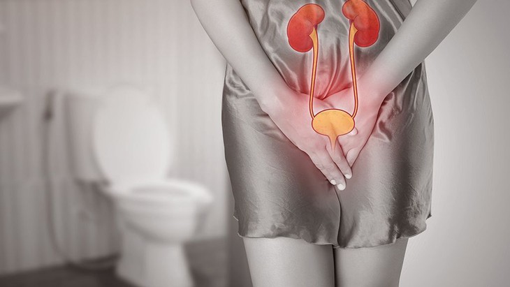Thói quen gây viêm đường tiết niệu ít người biết- Ảnh 2.