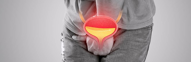 Thói quen gây viêm đường tiết niệu ít người biết- Ảnh 1.