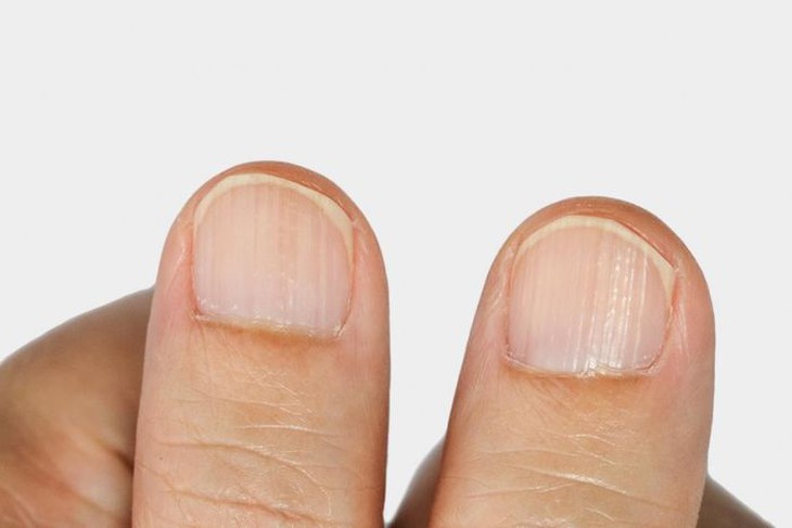 Hầu hết mọi người không quá chú ý đến móng tay vì họ không nghĩ rằng nó quan trọng.