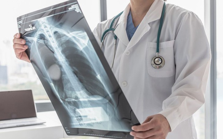 Gần 30% bệnh nhân được chẩn đoán ung thư phổi không tế bào nhỏ giai đoạn sớm