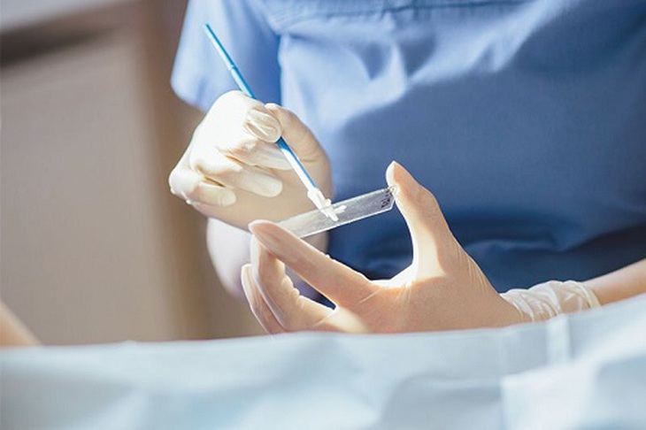Cách xác định bạn có nguy cơ mắc ung thư cổ tử cung không?- Ảnh 3. Cách xác định bạn có nguy cơ mắc ung thư cổ tử cung không?- Ảnh 3.