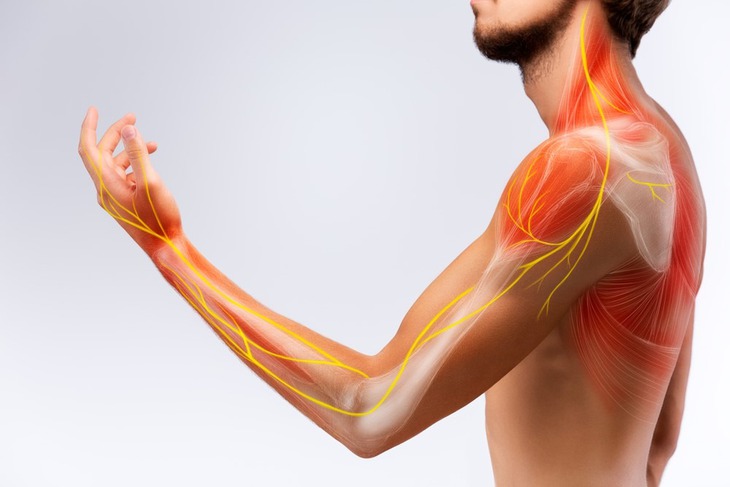 Tê tay, chân... cảnh giác với viêm đa dây thần kinh- Ảnh 1.