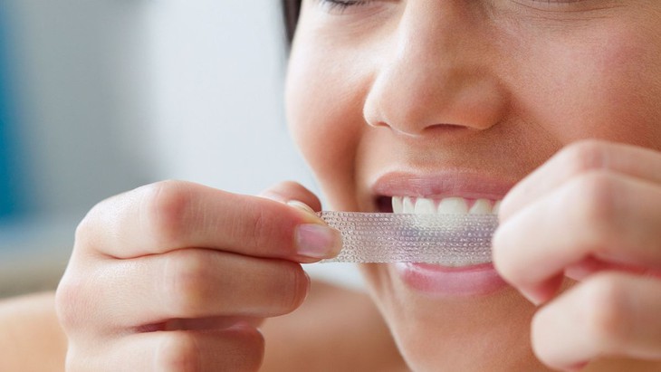 Có nên tự tẩy trắng răng tại nhà?- Ảnh 1.