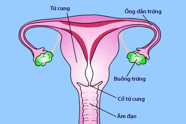 Viêm vùng chậu là bệnh gì, có gây vô sinh không?- Ảnh 1.