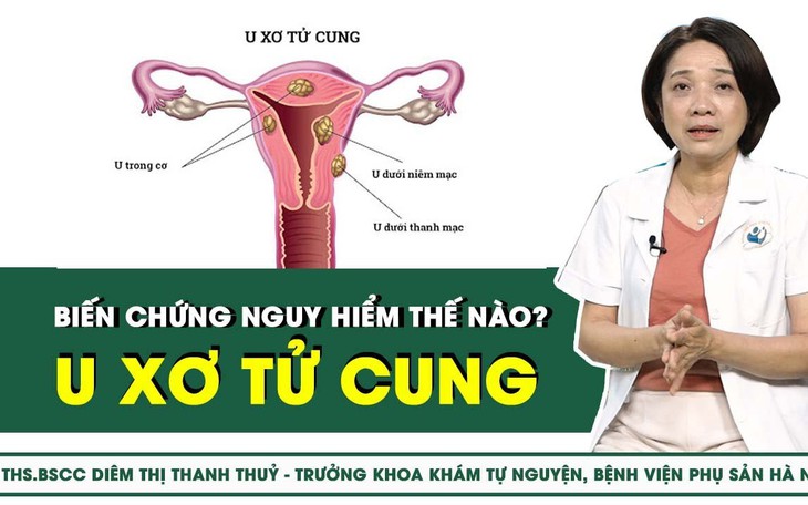 U xơ tử cung biến chứng nguy hiểm thế nào?