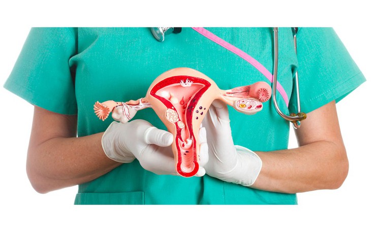 Phụ nữ nên biết 7 nguyên nhân gây ung thư buồng trứng
