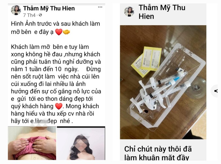 Hoại tử da bụng do hút mỡ tại cơ sở cắt tóc, làm móng- Ảnh 1.
