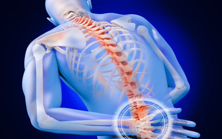 Đau lưng cảnh giác với u cột sống